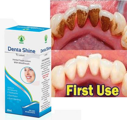 denta Rwhc Ayurvedic 100% Teeth Lotion Teeth Whitening liquid