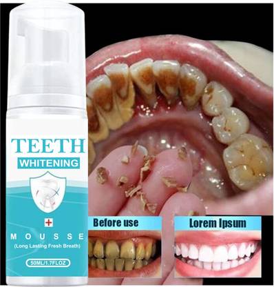 Latibule Mousse Toothpaste Remove Plaque Oral Odor Cleansing teeth Mousse Bright Teeth Teeth Whitening Kit