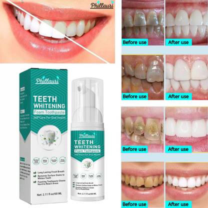 Phillauri Teeth Whitening Foam Effortless Teeth Brightening Teeth Whitening Kit
