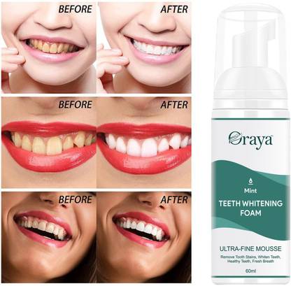 Oraya Teeth Cleansing Mousse Foam ,Deeply Cleans, Fights Bad Breath- - Mint