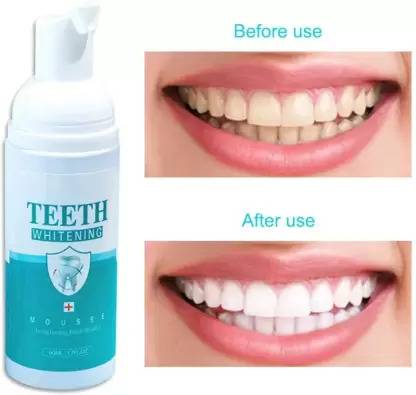 Quprak Teeth Whitening Foam To Removes Bad Breath Fights Germs - Mint Flavor Teeth Whitening liquid