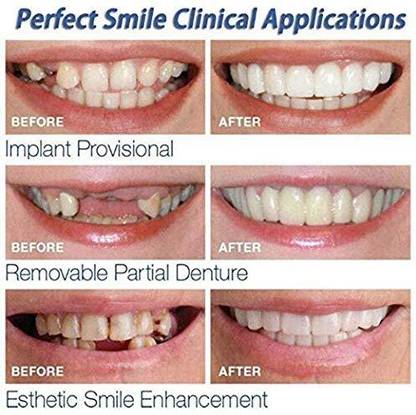 CODIX Teeth Instant Veneers Dentures Fake Teeth Braces Whitening Teeth Wipe