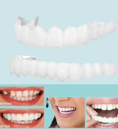 SOJITRA Teeth and Whitening Tooth (1Top+ 1Bottom+2Adhesives) Teeth Wipe (Pack of1) Teeth Wipe