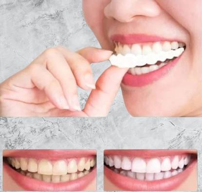 Shital Snap-on veneers provide a smetic solution for achieving a perfect white smile, Teeth Wipe