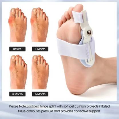 Black mirror Toe straightener bunion corrector splint with toe fracture support