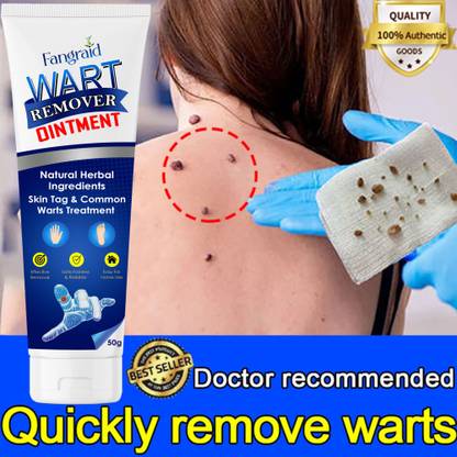 Alia Wart remover ointment cream for Body Anti wart removal