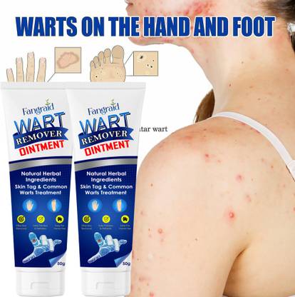 UPASTHIT Wart remover ointment cream for clean wart free Natural skin Men & Women