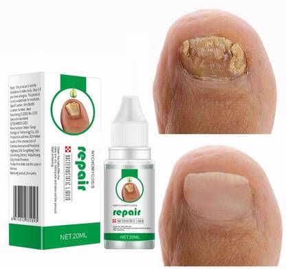 BNF Professional nails repair Solution 20ml for Damaged Discolored Yellow Nails Men & Women