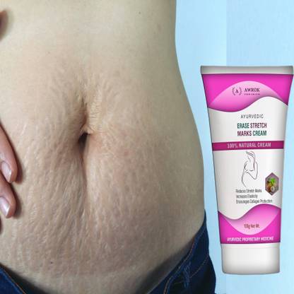 AWROK Stretch Marks Scar removal for anti Cellulite,remover scars