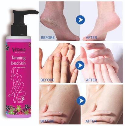vexana Beauty Tanning Dead Skin Remover Men & Women