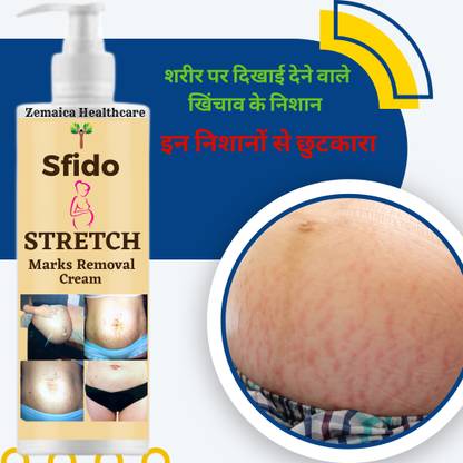 Zemaica Healthcare Stretch Marks Minimize , Stretch Marks & Even Out Skin Tone Men & Women