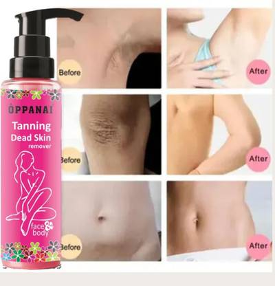 oppanai Pack of 1-Tanning Dead Skin Remover Helps in Skin Brightening-017 Men & Women