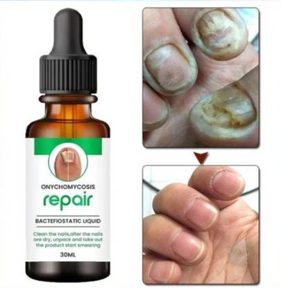 VIVAGLO Nail Serum Boost Nail Strong & Repair Nails pack of 1 Men & Women