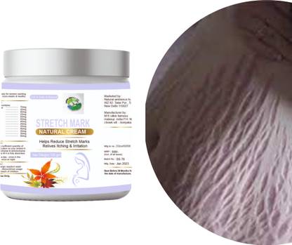 Natural ambience hub Stretch Mark Creams to Remove dark scl Men & Women