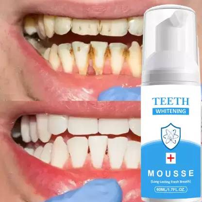 Quprak Teeth Whitening Foam To Removes Bad Breath Fights Germs - Mint Flavor Teeth Whitening Kit