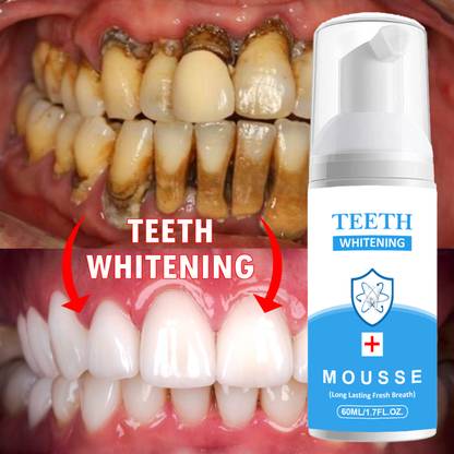 Vishvambhari Teeth Whitening Deeply Clean Gums Intensive Stain Removal Freash Breath Toothpaste