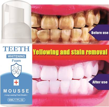 Prifakt Teeth Brighting Toothpaste For Your Smile With Our Teeth Whitening Foam Toothpaste