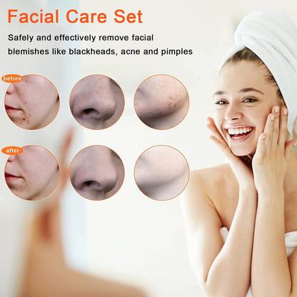 Luster Shine Blackhead Remover Tool Whitehead Pimple Extractor Acne Comedone Spot Popper Tool