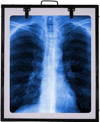 bdtc X-Ray View Box Digital for Clinic LED Premium Single Film |Brightness Adjustment X-Ray Viewer