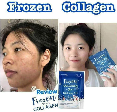 FROZEN COLLAGEN 2 IN 1 WHITENING X 10 CAPSULES FOR FAIRNESS Price in India  - Buy FROZEN COLLAGEN 2 IN 1 WHITENING X 10 CAPSULES FOR FAIRNESS online at  Flipkart.com