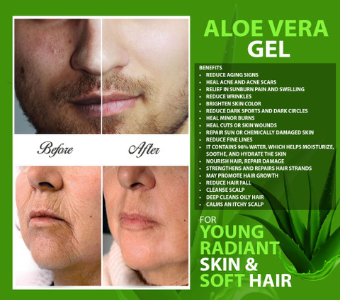 aloe vera gel sante Aloe Vera Gel main image 1