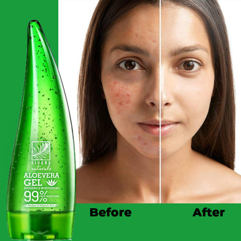 buy aloe vera gel Aloe Vera Gel – Beauty by Earth