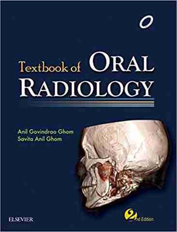 Textbook Of Oral Radiology: Buy Textbook Of Oral Radiology by Anil ...