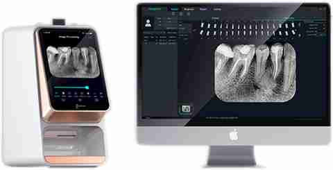 Psp Scan Ids PSP SCANNER I SCAN X-Ray Viewer Price in India - Buy Ids PSP ...