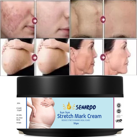 SENAROO Stretch Marks Cream for Pregnancy with the Natural Goodness of Aloe  Vera 50ML Price in India - Buy SENAROO Stretch Marks Cream for Pregnancy  with the Natural Goodness of Aloe Vera