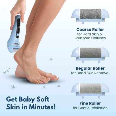 Electric フットケア Callus File Foot Waterproof - Remover Callus Electric SKINCE Remover フットケア