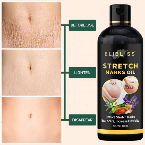 ELIBLISS Stretch Marks Removal Oil and Aloe Vera and Neem Face Wash for All  Skin Type Price in India - Buy ELIBLISS Stretch Marks Removal Oil and Aloe  Vera and Neem Face
