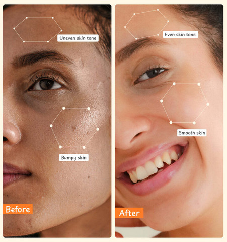celluvie glutathione CELLUVie ®