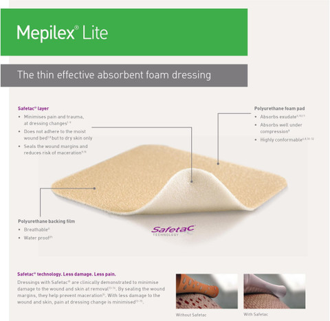 Mepilex Lite 10*10 Foams Virtually Painless and Most Effective