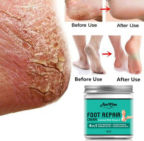 AroMine Foot Cracked Repair Cream For Healing Sooting Of Cracked Heels-