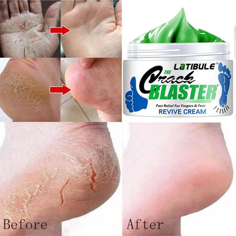 Latibule Foot Crack Cream For Dry Cracked Heels Feet
