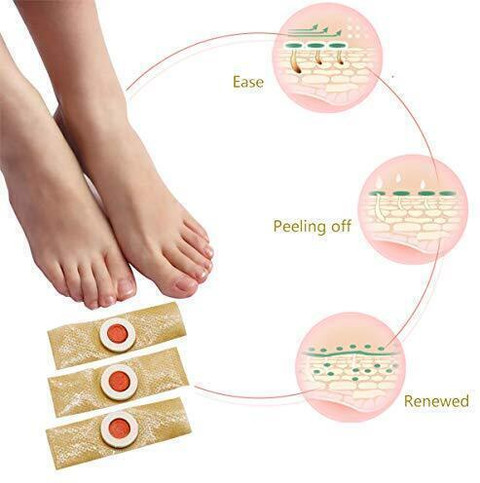 Fotnil Medicated Corn Caps for Fast Effective Deep Foot Corn Remover PACK  OF Adhesive Band Aid