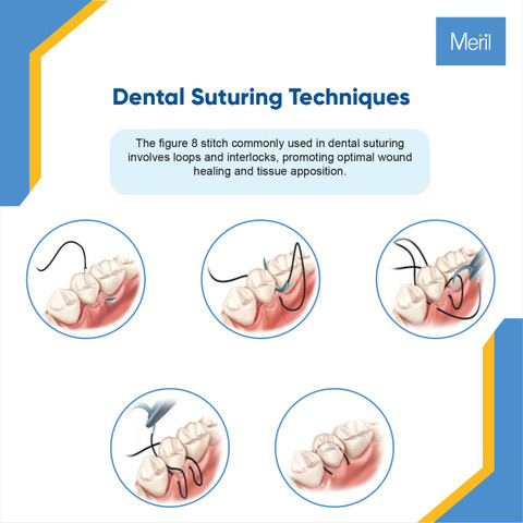 Meril Models Meril Dental Suture kit for training , 4 Different suture pads to ...