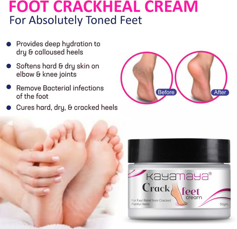 Kayamaya Foot Care Cream Heal Cracked Heels, Naturally Price in