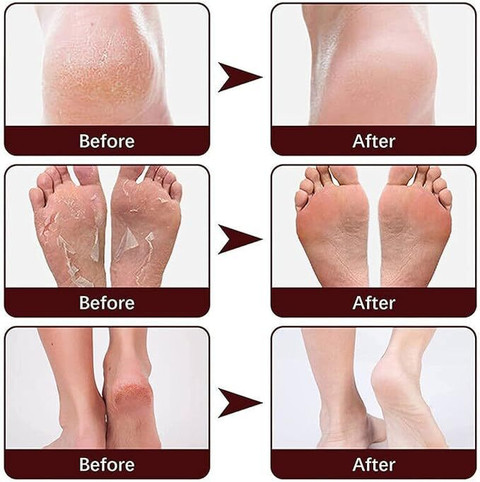 GoReady Foot Repair Cream for Foot Fungus, Dry Cracked Feet and - Main Image