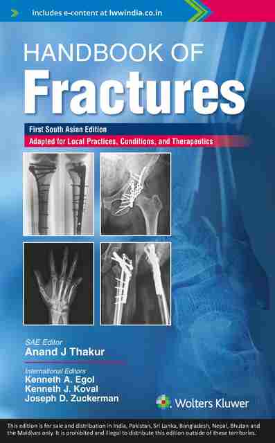 Handbook of Fractures Egol MD， Kenneth、 Koval MD， Kenneth J.; Zuckerman MD， Joseph handbook-of-fractures-original