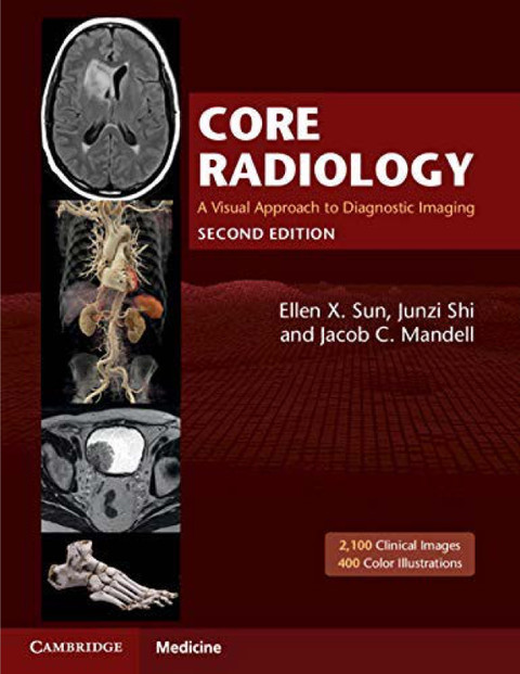 Core Radiology: A Visual Approach To Diagnostic Imaging 2nd