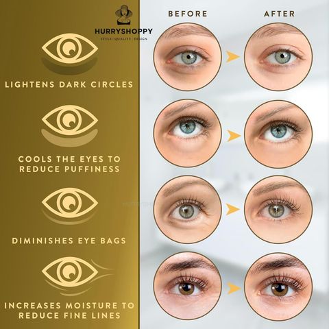 HurryShoppy Under Eye Mask Sheet Patches for Dark Circle Women Men 24k Gold Eye Cooling Gel (60 g) - Image 4