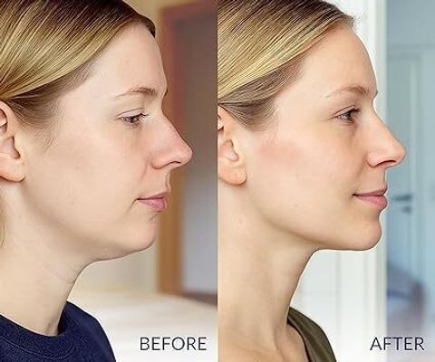 JUDEE Collagen V Lifting Gel Mask | Double-chin Mask | Instant Cooling & Depuffing Face Shaping Mask - Image 6