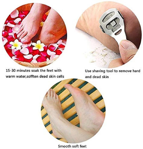 Foot Callus Remover Pedicure To Get Rid Of Hard Skin Sweetpea