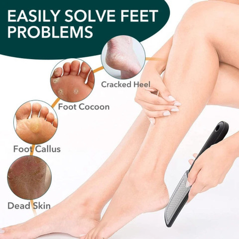 SIYDHA Best Quality Foot Scrubber For Dead Skin Cracked Heels Crack  Callus Remover