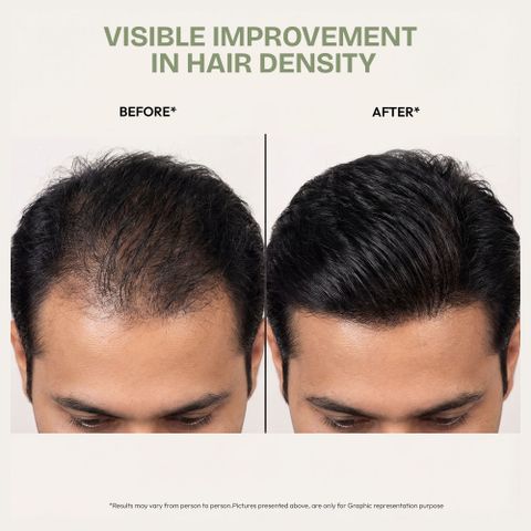 Proskire Ultimate Hair Growth Oil 100ml - Image 8