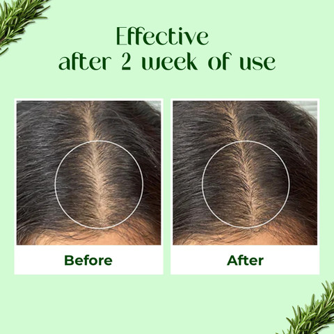 sheny soft Hair Growth, Rose mary water spray Rose marry Rose