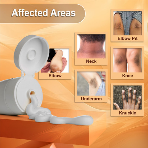 ★新品★GENOMER DERMA CREAM 45g ジェノマー / ダーマクリームの公式商品情報｜美容・化粧品情報