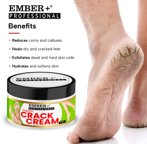 Dry Cracked Heels Dry Hard Feet Ember Cream For Rough, Dry And