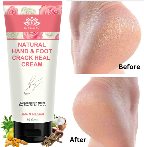 INTIMIFY Crack Cream For Dry Cracked Heels, Hand Feet, Crack Heel Repair  Cream